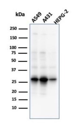 GCLM Antibody (CPTC-GCLM-1) - Azide and BSA Free, Novus Biologicals 100